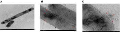 Proteome Analysis of Outer Membrane Vesicles From a Highly Virulent Strain of Haemophilus parasuis